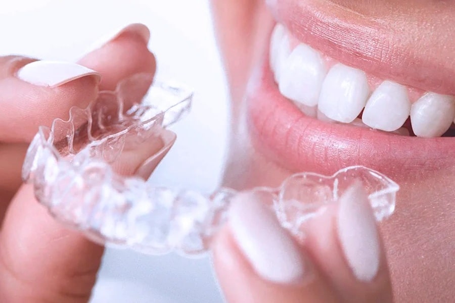 Элайнеры для зубов в Нижнем Новгороде – стоимость лечения в стоматологии Смайлик